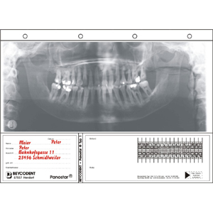 Panostar Typ 1 - Panorama-Röntgenfilm-Kartei- Nachfüllungen