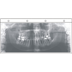 Röntgen-Panoramasichthüllen 12 x 30 cm, Typ 1011